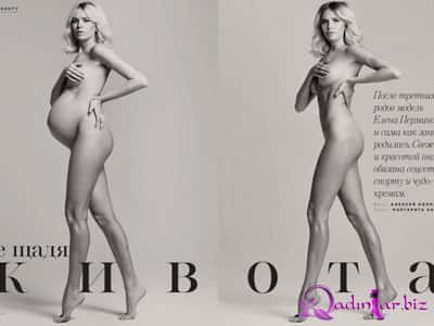 Rus model hamiləlikdən əvvəl və sonra - fotolar