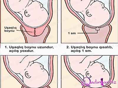Doğuma hazırlıq ETAPLARLA - Fotolar