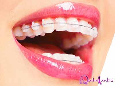 Ortodontik müayinə nə vaxt edilməlidir?