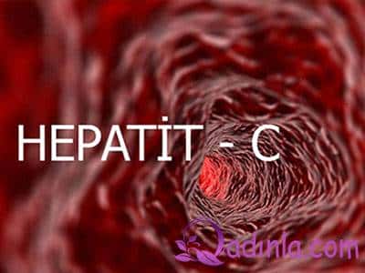 Ölümcül olan hepatit C xəstəliyi haqqında