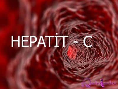 Kimlər daha çox Hepatit C riski daşıyır